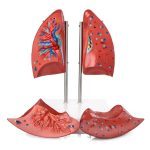 Lung Model - Image 2