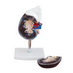 Human Kidney with Adrenal Gland - Image 2
