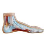 Normal, Flat and Arched Foot - Image 2