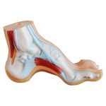 Normal, Flat and Arched Foot - Image 4