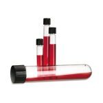 Test Tube Glass Screw Cap
